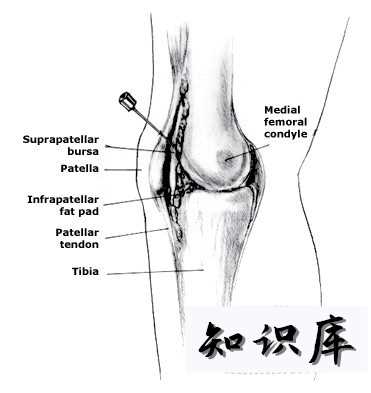 什么叫打封闭对人体有害吗 打封闭针对人体有哪些危害